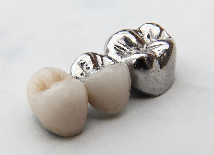 Dental Fillings & Restorations